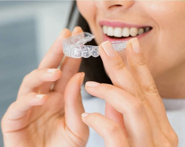 dental veneers liverpool