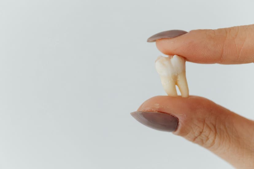 wisdom tooth extraction liverpool