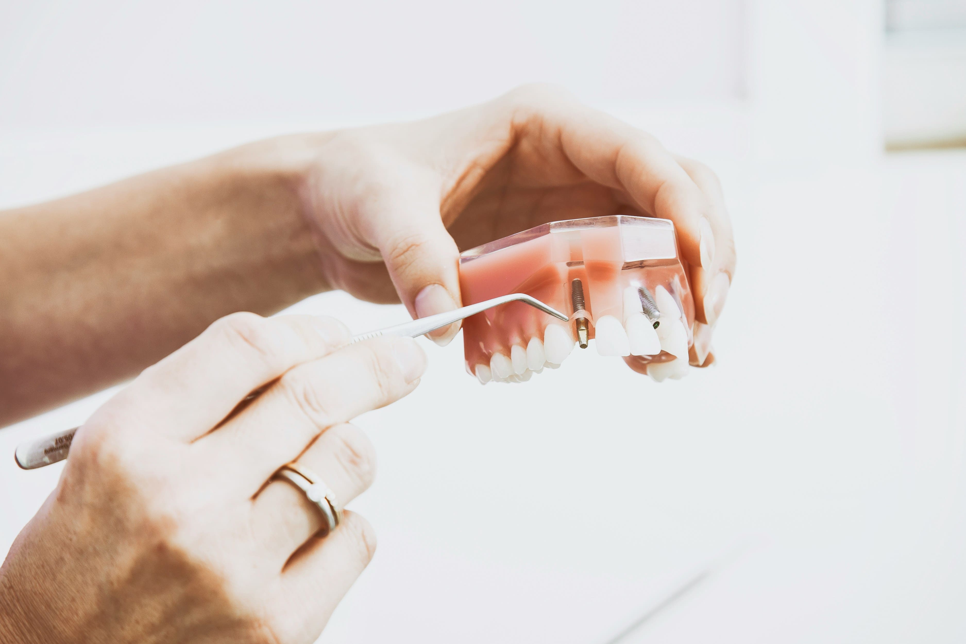 dental implant treatment in liverpool
