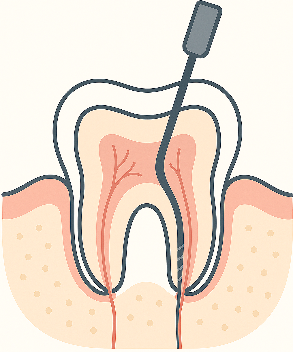 root canal treatment liverpool